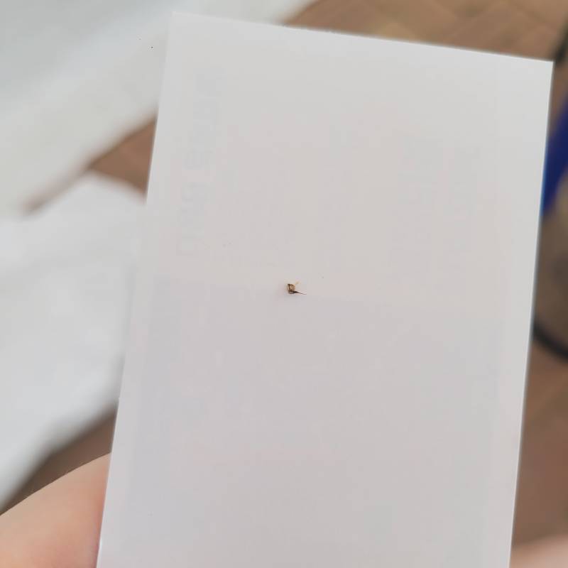 [잡담] 아니 씨ㅠㅠ 이거 벌침이야? | 인스티즈
