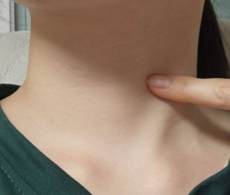 [잡담] 목이 부은것 같은데 갑상선 위치인지 봐줄 익..? | 인스티즈