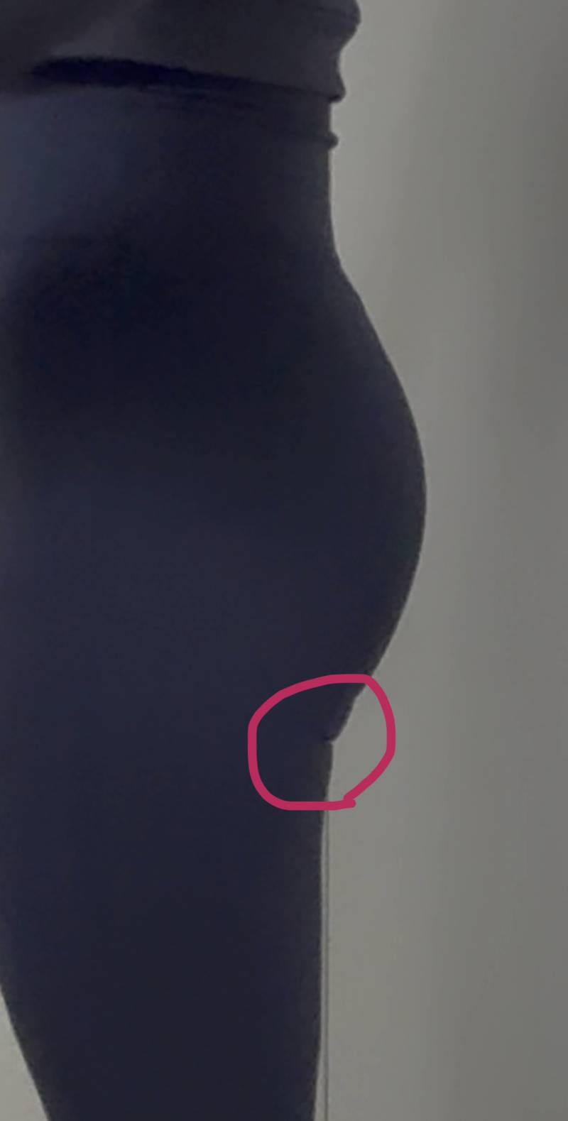 [잡담] 레깅스 입었을 때 엉덩이 아랫부분 이렇게 접히는 건 왜 때문이지?ㅠㅜ | 인스티즈