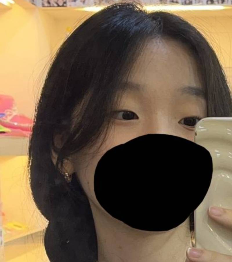 [잡담] 쌍수할까? | 인스티즈