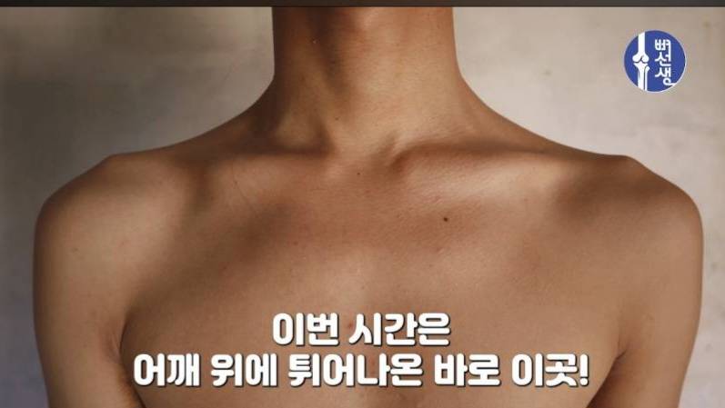 [잡담] 어깨뼈? 쇄골이랑이어진 부분이 돌출되어있는거 그냥뼈모양인가..? | 인스티즈