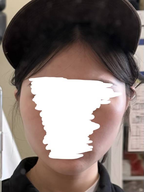 [잡담] 다이어트 전후인데 얼굴 차이 좀 나 ? | 인스티즈