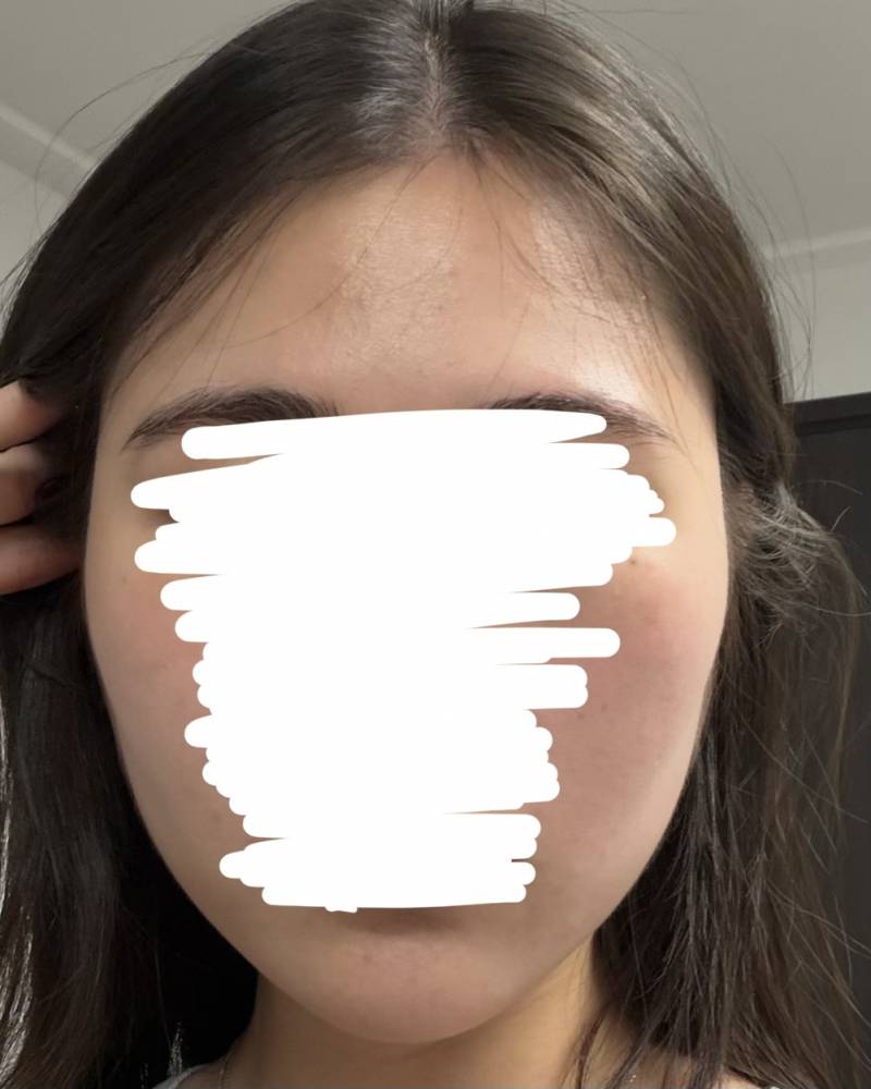 [잡담] 다이어트 전후인데 얼굴 차이 좀 나 ? | 인스티즈