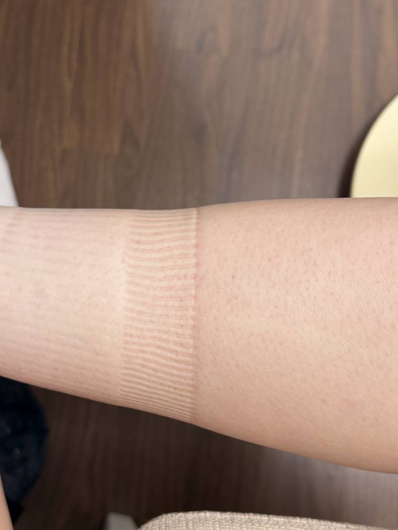 [잡담] 다리붓기 대애박 | 인스티즈