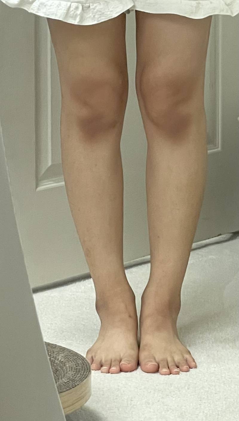 [잡담] 나 다리 어때 보여??? 심각하게 통뼈 맞지?ㅠㅠ | 인스티즈