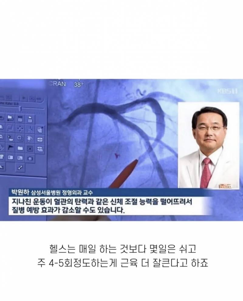 [잡담] 운동 매일 하면 효과 없다길래 이거지~ 하고 봤는데 | 인스티즈