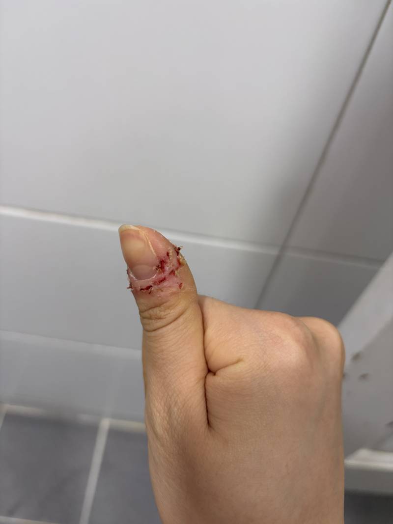 [잡담] 정병 레전드 손톱 | 인스티즈