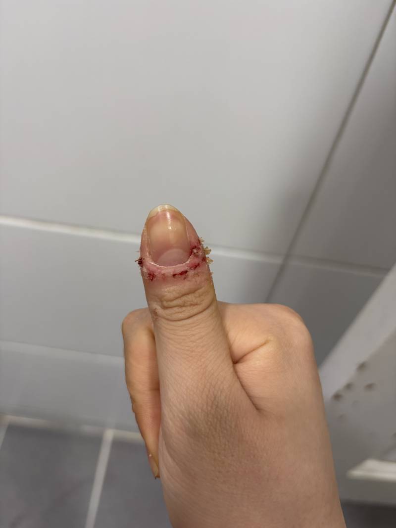 [잡담] 정병 레전드 손톱 | 인스티즈