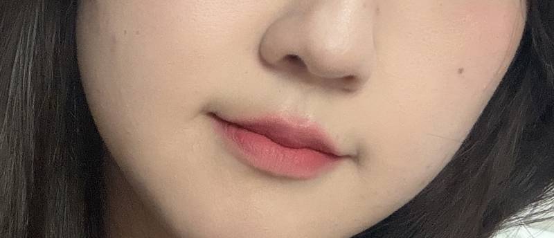 [잡담] 입술필러 !!! | 인스티즈