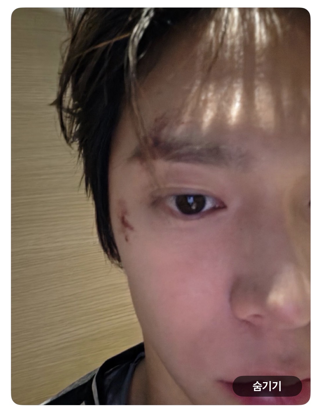 [잡담] 아,, 라이즈 콘텐츠 경고 나만 뜨냐 | 인스티즈