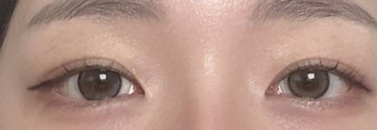 [잡담] 렌즈 뭐가 나아? | 인스티즈