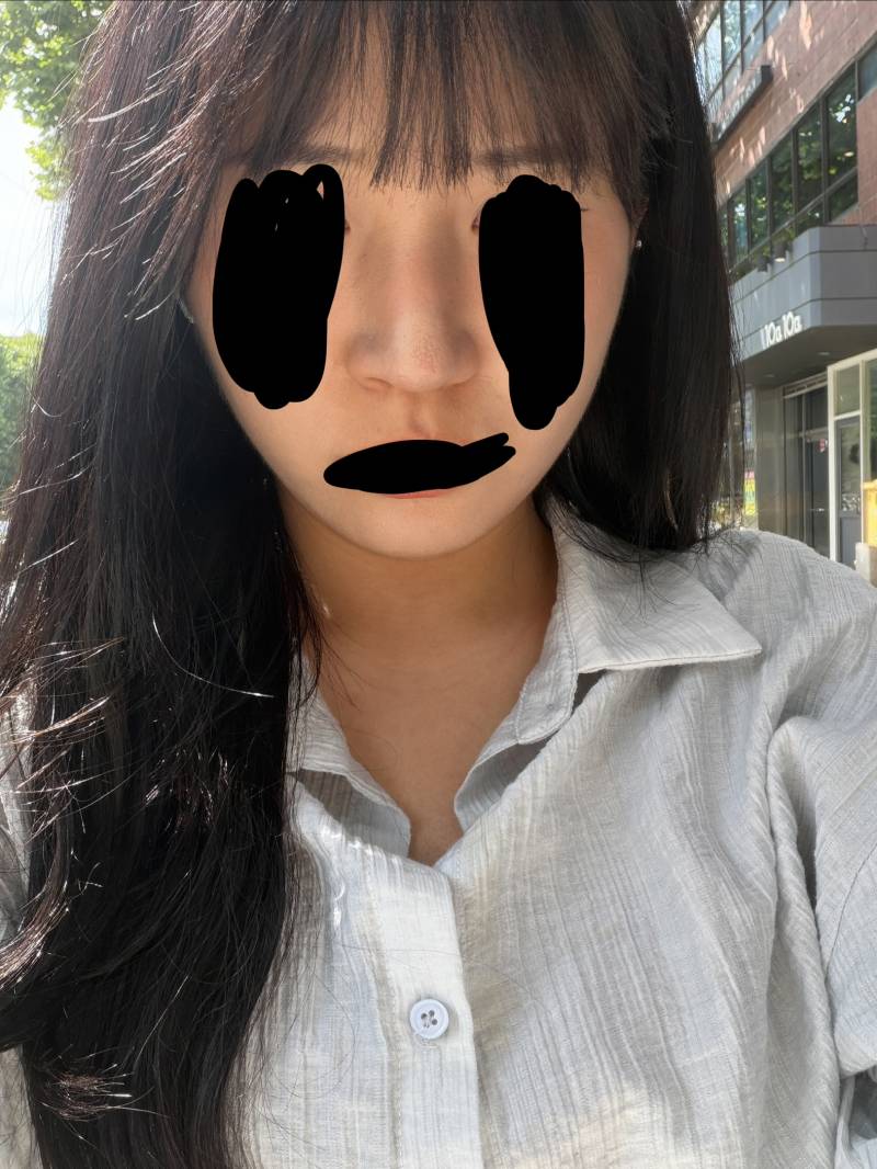 [잡담] 너네라면 이 코 코수술 할것같음? | 인스티즈