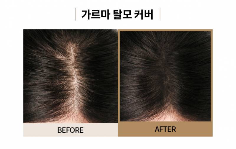[잡담] 정수리가 원래 일케 가득차야 하는 거야?? | 인스티즈