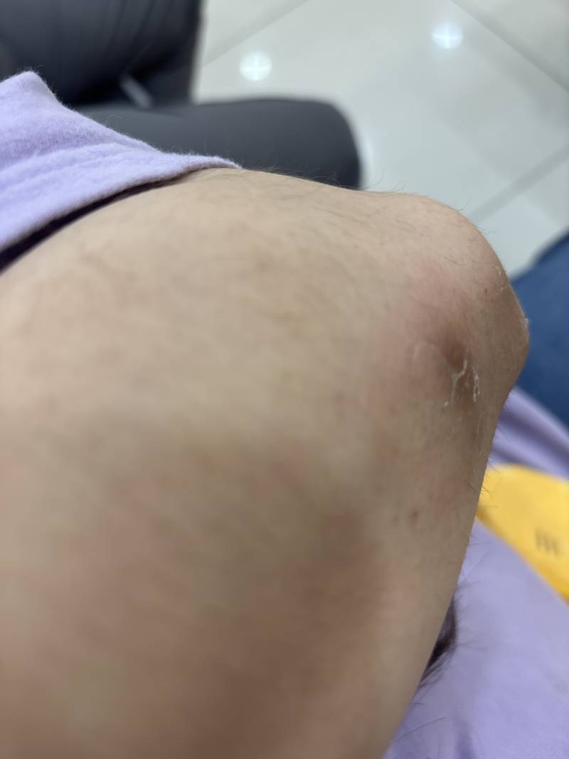 [잡담] 뭐임 이거 팔꿈치 | 인스티즈