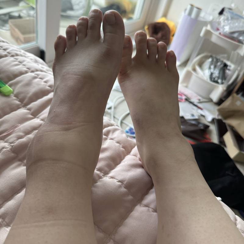 [잡담] 얘들아 굽 높은 거 신고 조심히 걸어... | 인스티즈