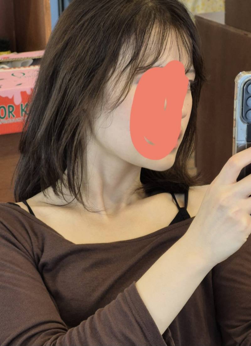 [잡담] 얘들아 나 사각턱보톡스 잘 받을것같음?사진있어 | 인스티즈