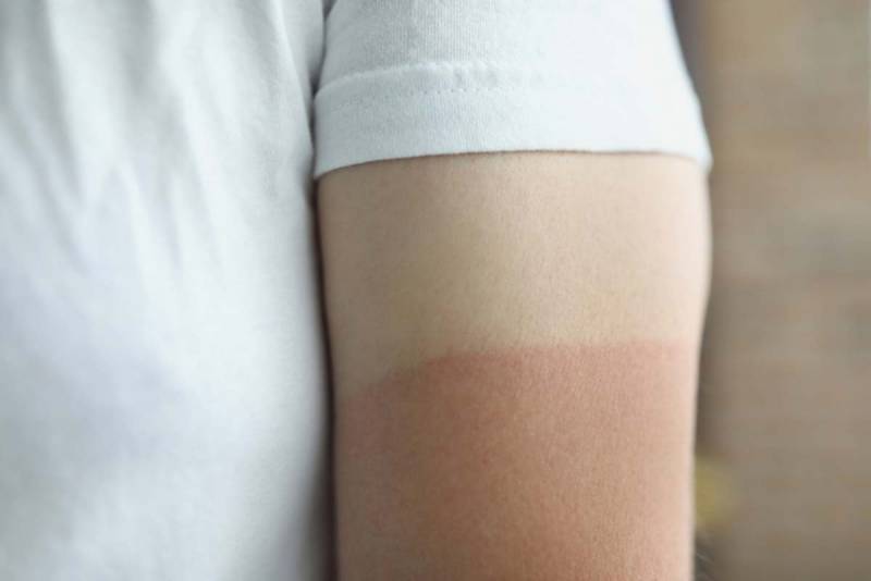[잡담] 진정한 럽욜셀프 피부는 이거지 | 인스티즈