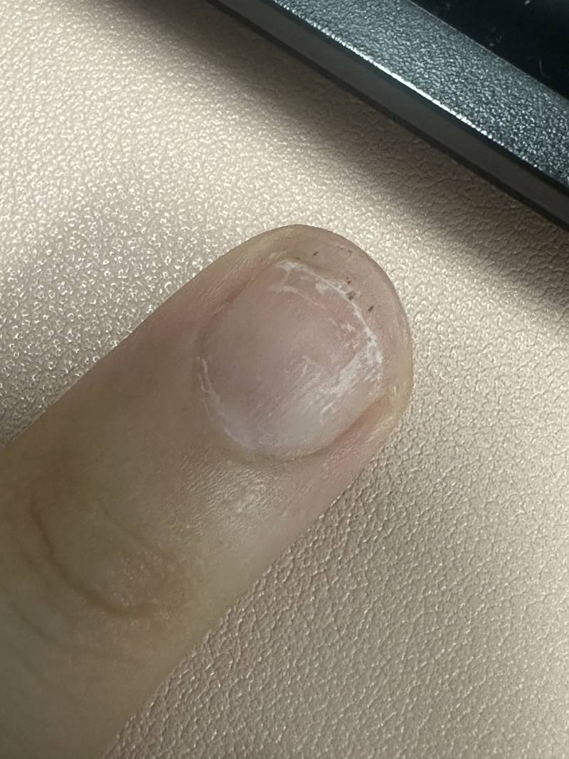 [잡담] 손톱 너무 짧으면 팁 잘 안 붙어있어? | 인스티즈