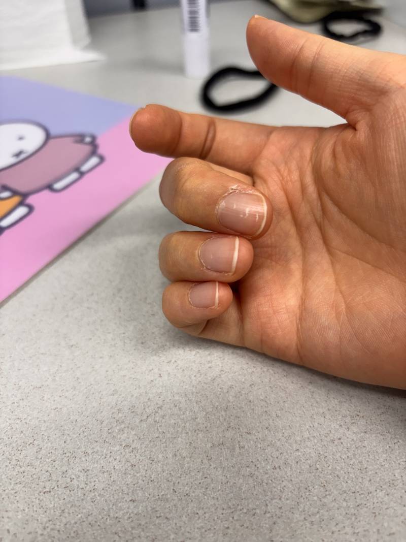 [잡담] 이런거 네일샵에서 케어 받으면 나아져??? | 인스티즈