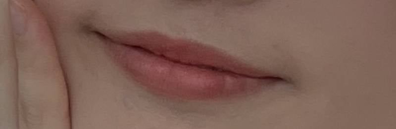 [잡담] 나 입술필러 하는게 낫겠지? | 인스티즈