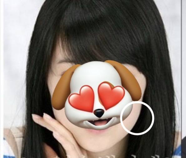 [잡담] 얼굴형에 이부분은 무슨 시술해야 효과볼까??... | 인스티즈