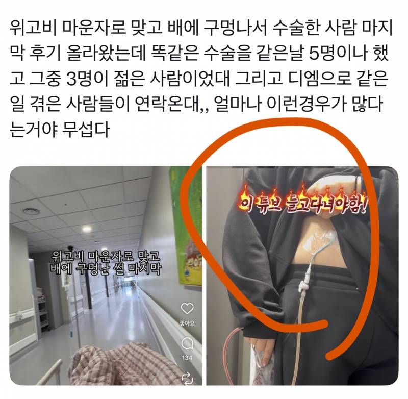 [잡담] 마운자로 이거 진짜야..? (약혐주의 | 인스티즈