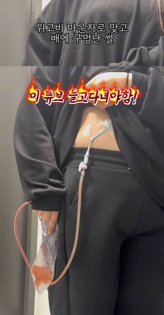 [잡담] 마운자로 이거 진짜야..? (약혐주의 | 인스티즈