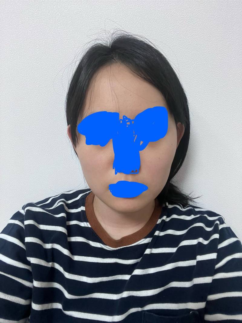 [잡담] 시술 추천해줄 수 있어? | 인스티즈