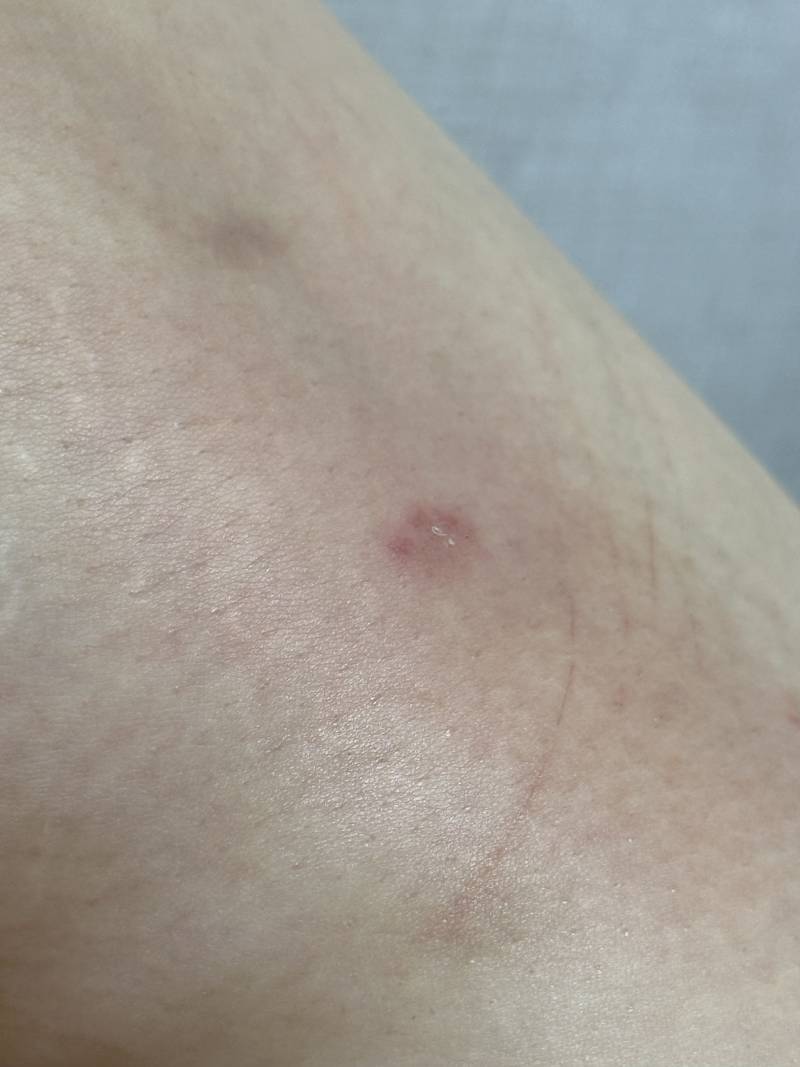 [잡담] ㅓ와 진짜 개가렵다 뭐지 | 인스티즈
