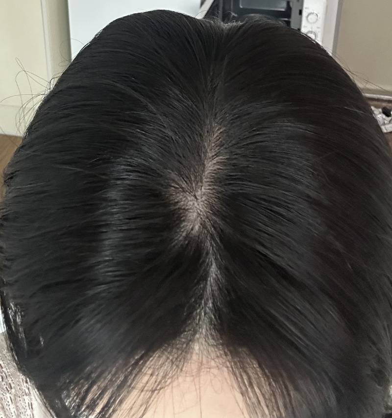 [잡담] 나 왜 묘하게 탈모 같지??????? | 인스티즈