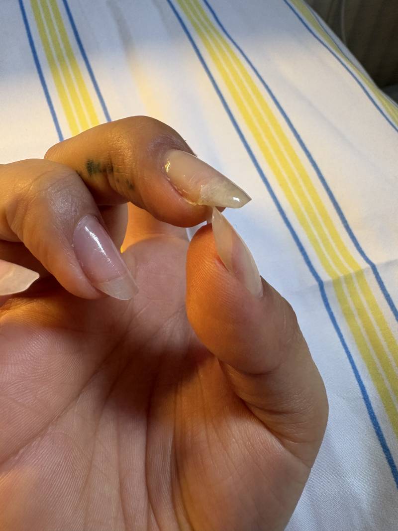 [잡담] 손톱 케어+찢어짐 보수했는데 환불해달라 할까? | 인스티즈
