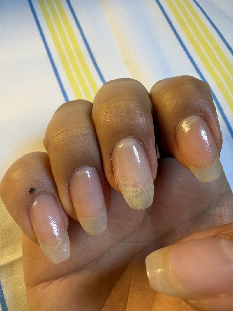 [잡담] 손톱 케어+찢어짐 보수했는데 환불해달라 할까? | 인스티즈