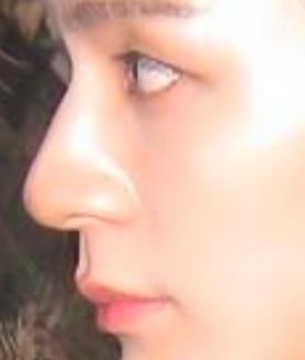 [잡담] 이 사진들고 코수술 하려고 하는데.. | 인스티즈