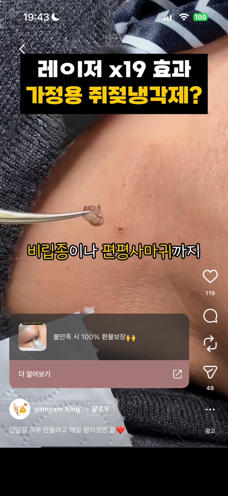 [잡담] 이거 진짜인가 비립종 없애고 싶른데 | 인스티즈