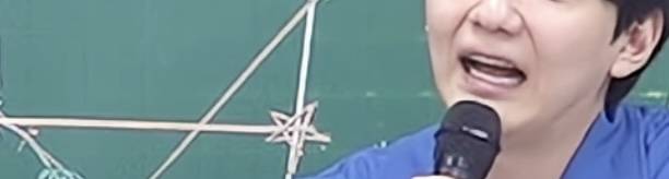 [잡담] 웃을때 이정도 팔자는 시술받는게 좋아?? | 인스티즈