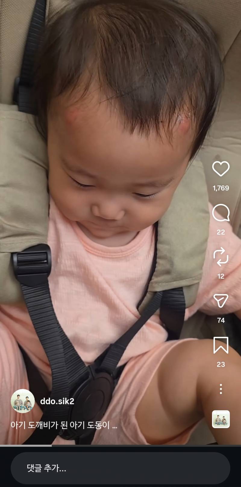 [잡담] 애기들은 모기물리면 일케되나봄... | 인스티즈