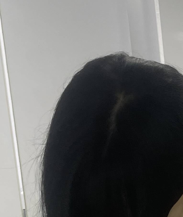 [잡담] 나 탈모 온건가...? 갑자기 생각니거 찍었는데 왱케 휑하지 | 인스티즈