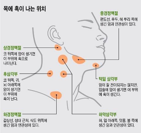 [잡담] 왼쪽 목에 멍울? 혹같은 거 생겻는데 병원 어디로 가야대?? | 인스티즈
