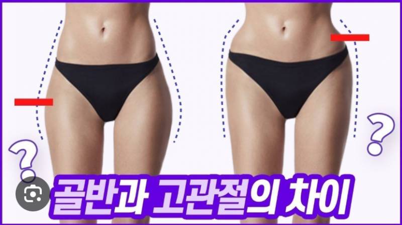 [잡담] 골반 개스트레스 받는다 | 인스티즈
