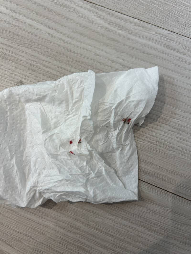 [잡담] 모기 잡음ㅋㅋ | 인스티즈