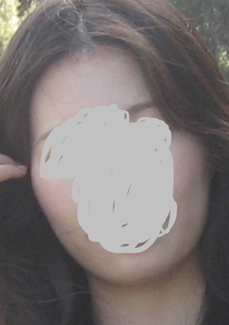 [잡담] 이런 얼굴형 시술이나 헤어스타일로 보완이 가능한 부분일까..? | 인스티즈
