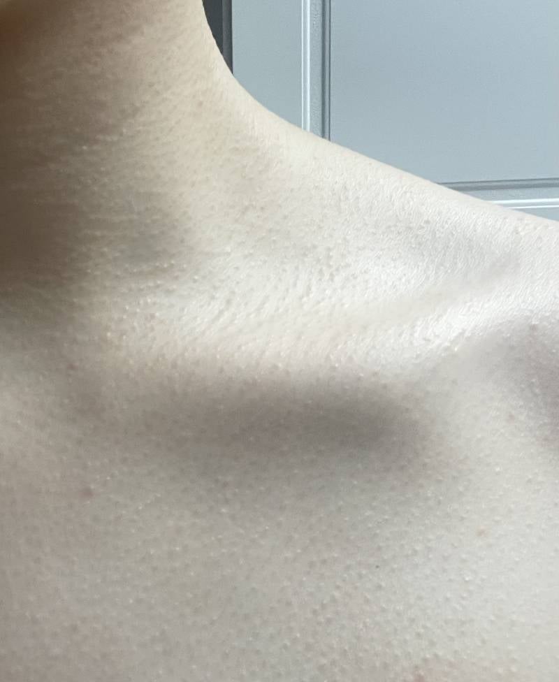 [잡담] 이런피부는 타고나는거임 ..? 절대 안바뀜..? | 인스티즈