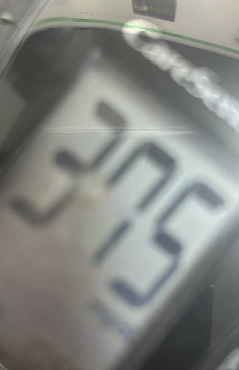 [잡담] 약 먹어도 몇달째 질염이 안 나아서 죽기 직전이었는데 당뇨였어 | 인스티즈