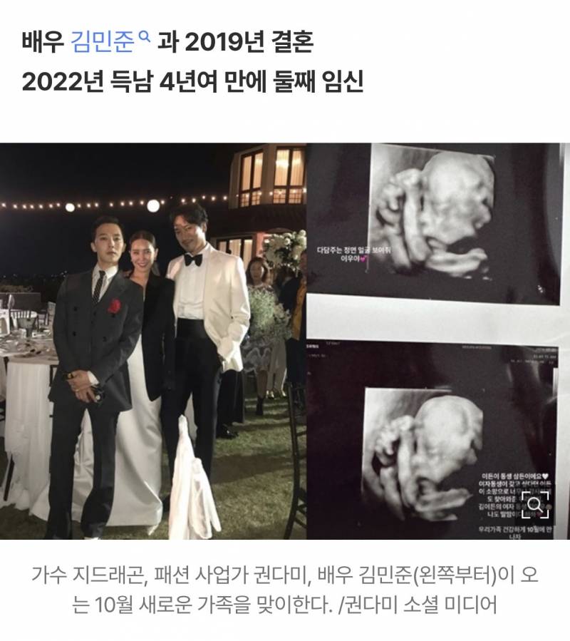 지드래곤, 여자 조카 생긴다..친누나 10월 딸 출산 예정 | 인스티즈