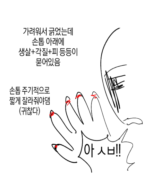 (충격) 아토피가 𝙅𝙊𝙉𝙉𝘼 힘든 이유..JPG | 인스티즈
