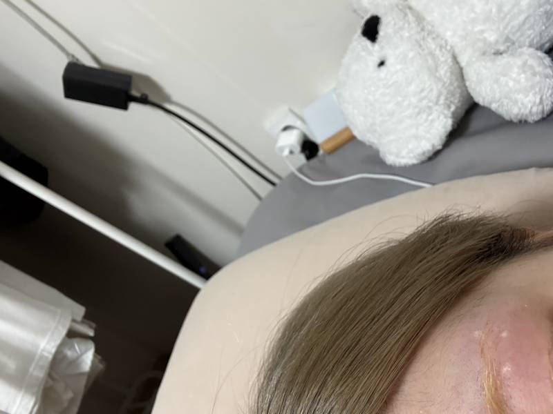 [잡담] 눈썹 탈색하다가 화상당한듯 | 인스티즈