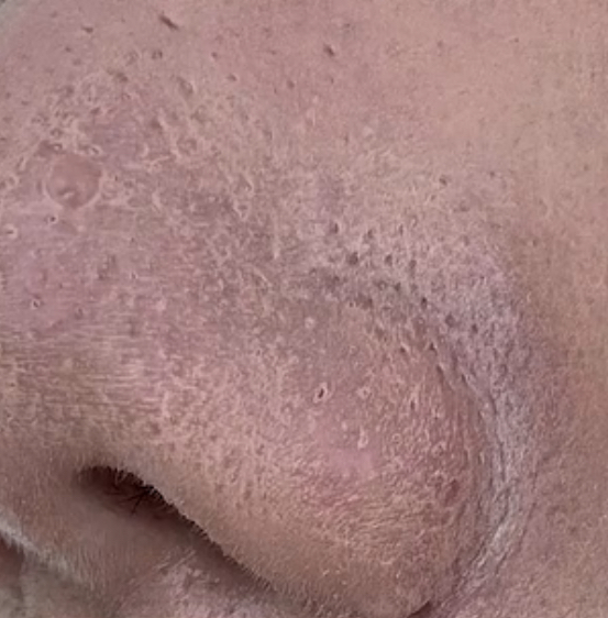 [잡담] 파데바르면 이렇게되는거 어케해야됨???? | 인스티즈