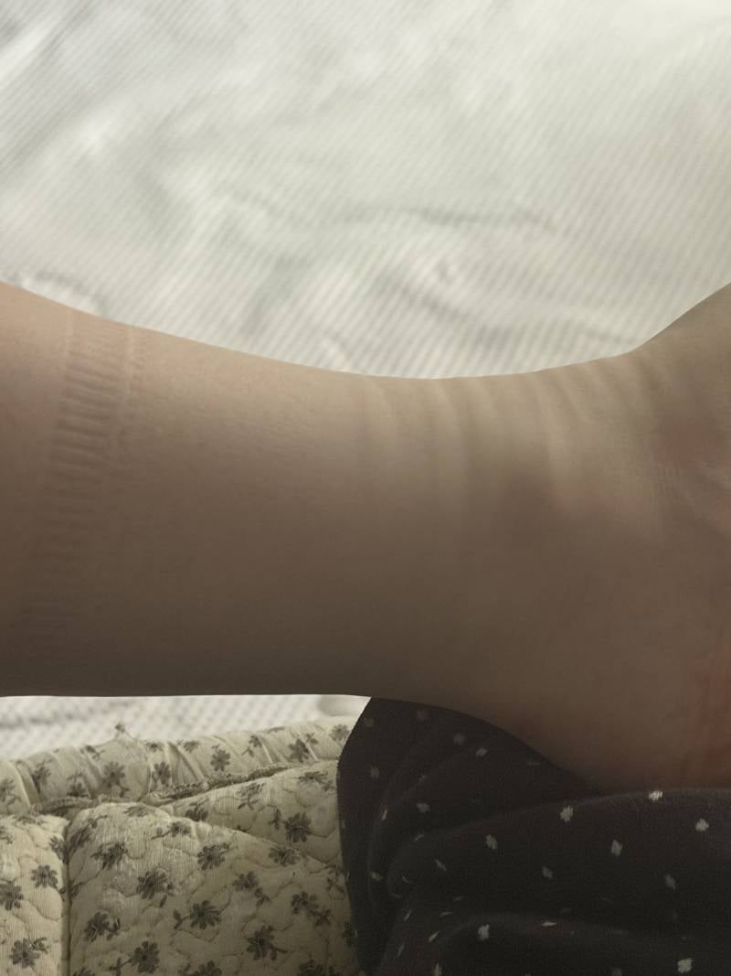 [잡담] 다들 다리 이정도로 부어? | 인스티즈