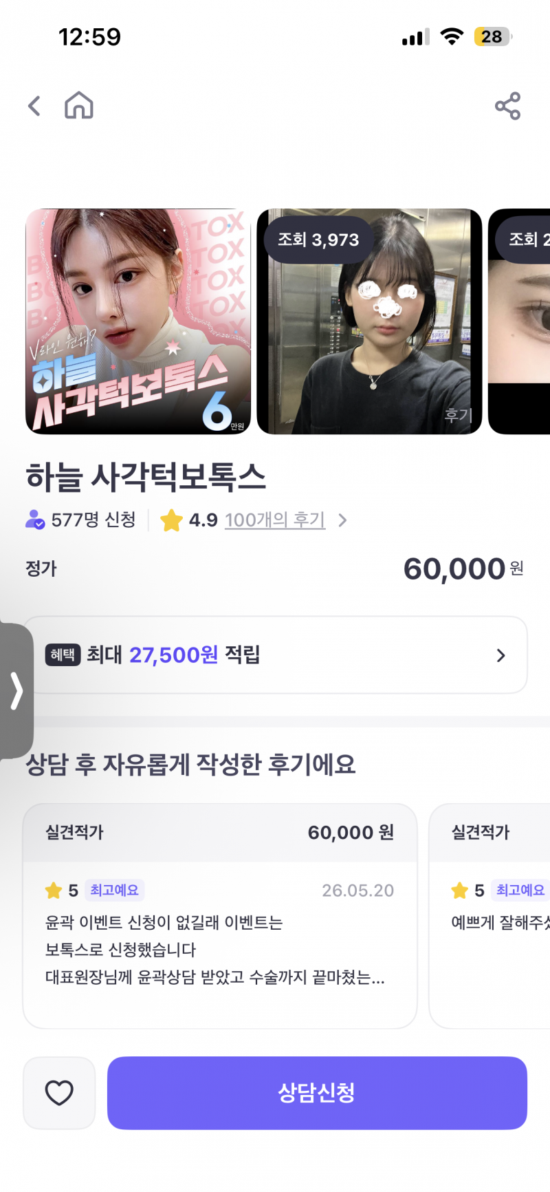 [잡담] ㅂㅂ톡 어플 사각턱 보톡스가 6만원이라는데 가서 상담받아도 | 인스티즈