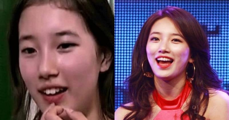 라미/제로네이트 한 연예인들 전후차이.jpg | 인스티즈